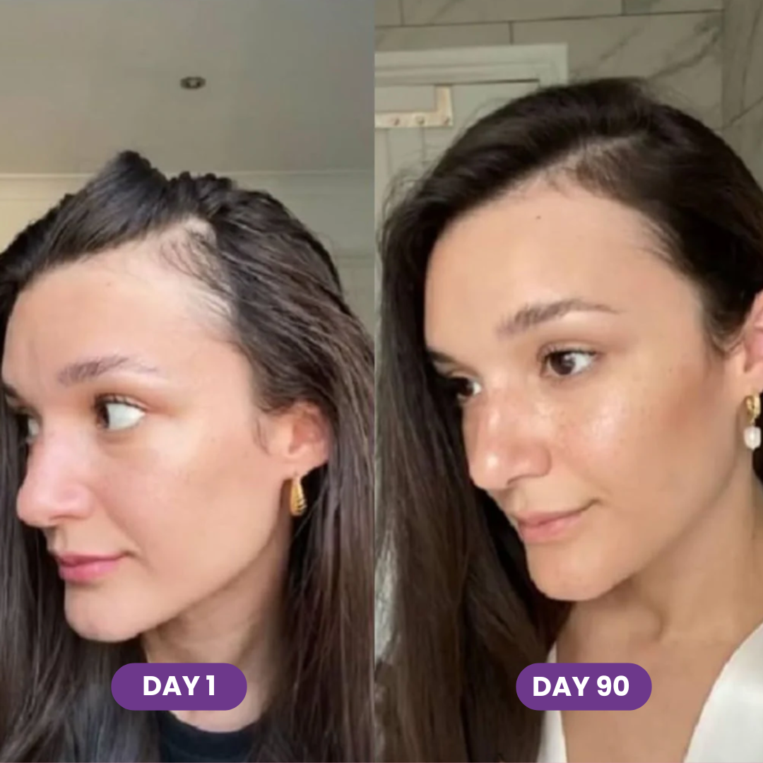 Hair Growth Accelerator Soft Chews